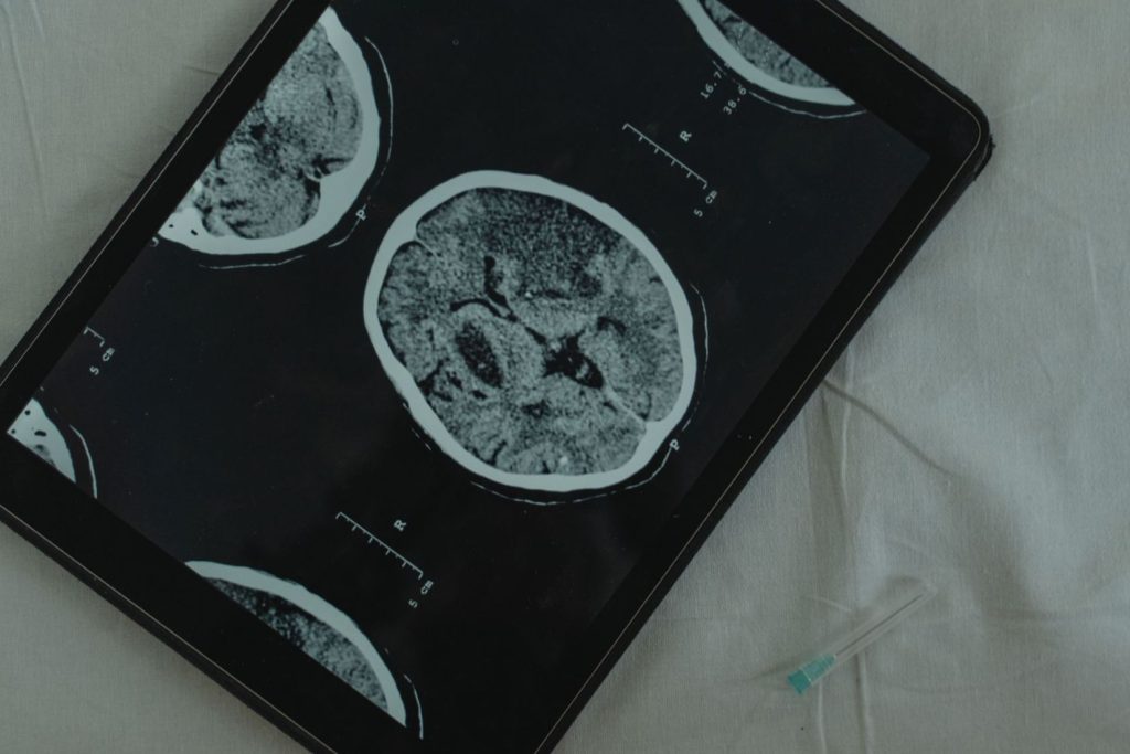 An image of a brain scan.